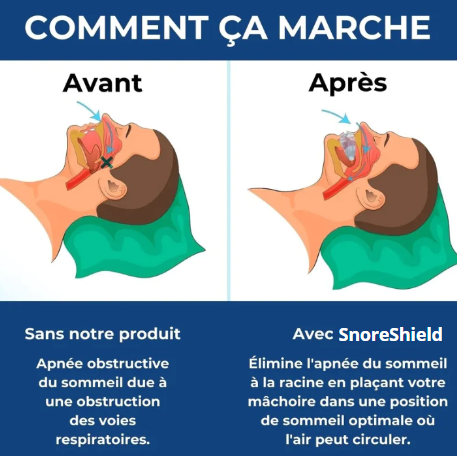 Appareil Anti-Ronflement